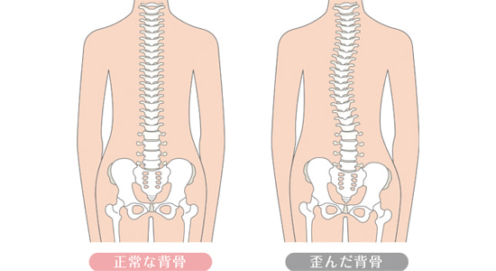 骨盤症状の図