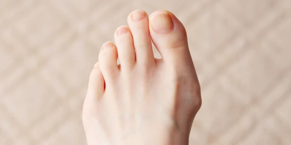 よくある誤解と、危険な「放置」