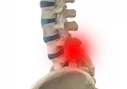 首下がりとは？