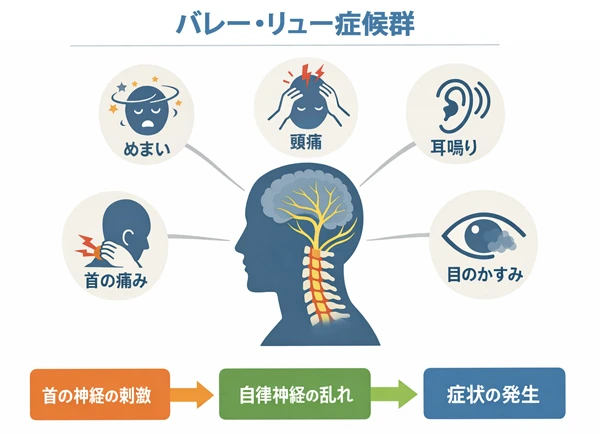 バレー・リュー症候群とは？