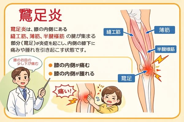 鵞足炎の症状の説明
