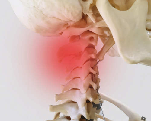 頚椎症(けいついしょう)とは？